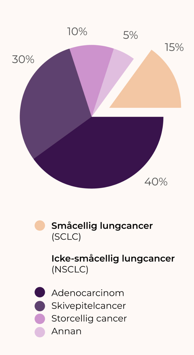 Grafik över typer av luncgancer